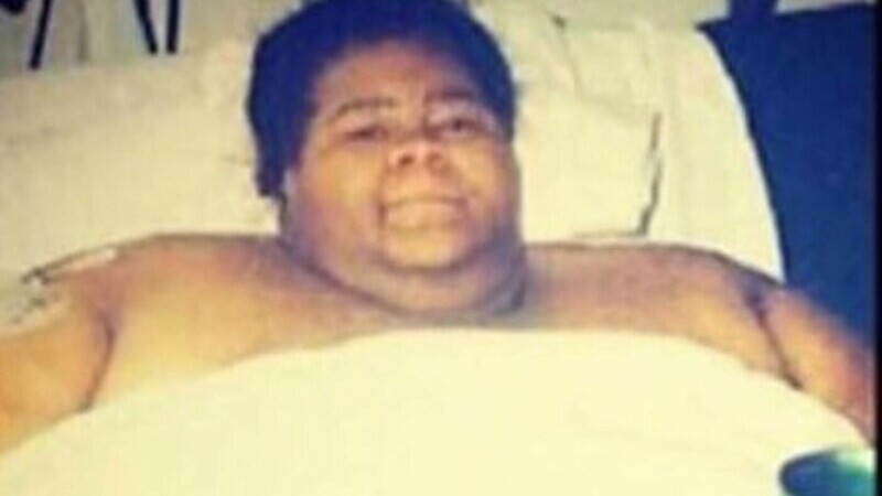 Femeia din imagine avea peste 450 de kilograme, în 2005