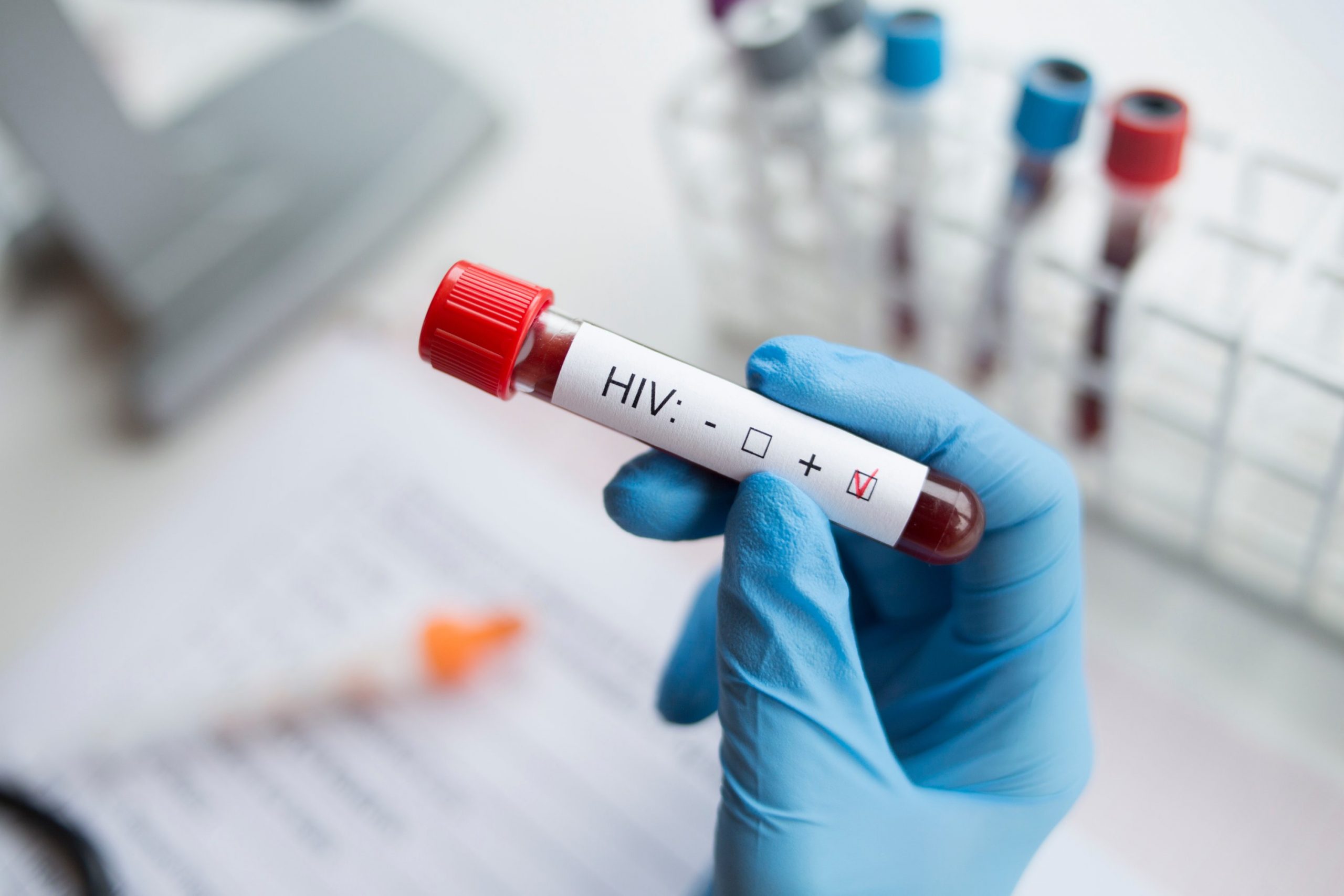 Tehnologia Crispr a reușit să elimine HIV-ul din celule infectate