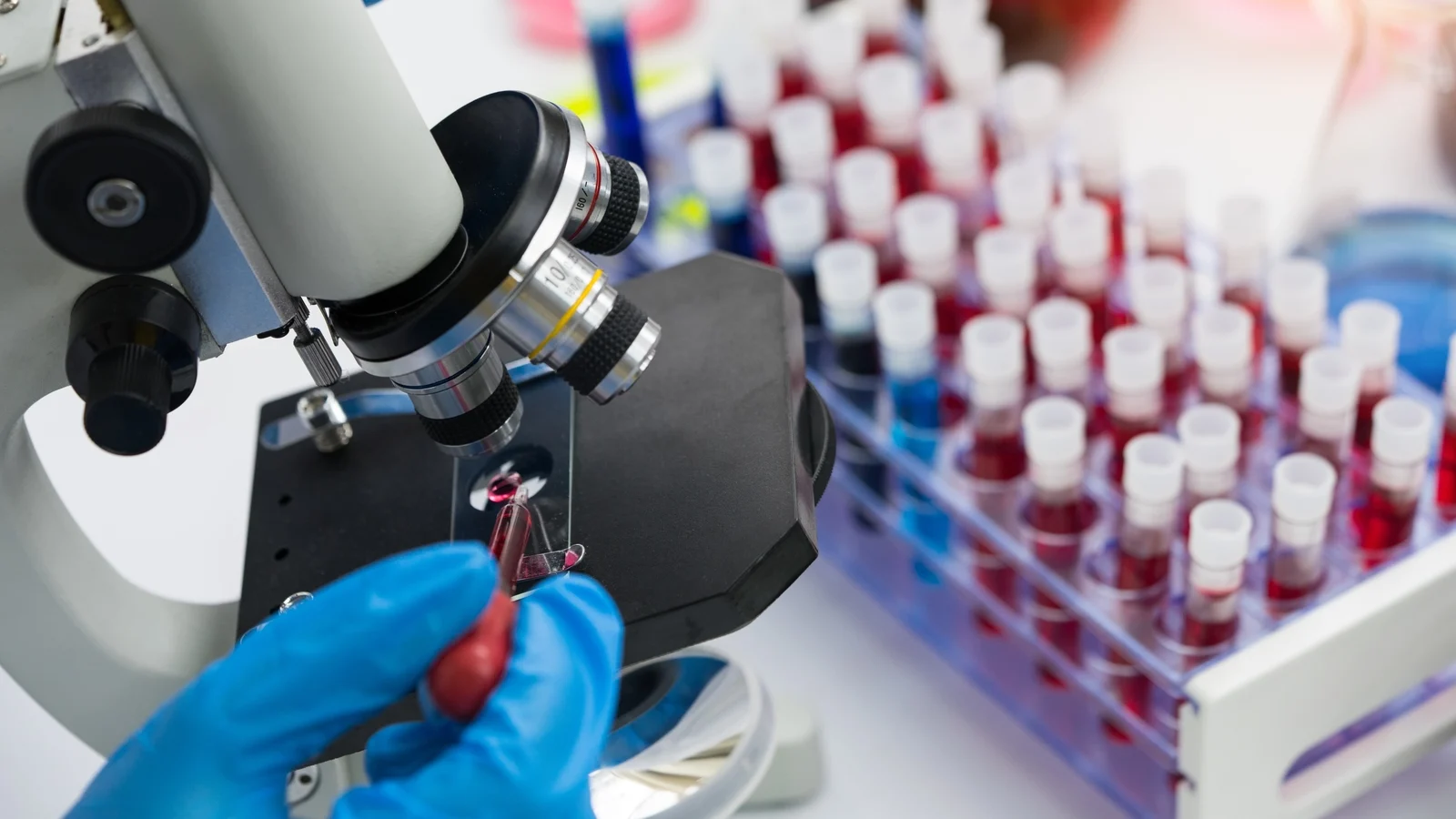 Cercetătorii au creat un cip care detectează celulele canceroase